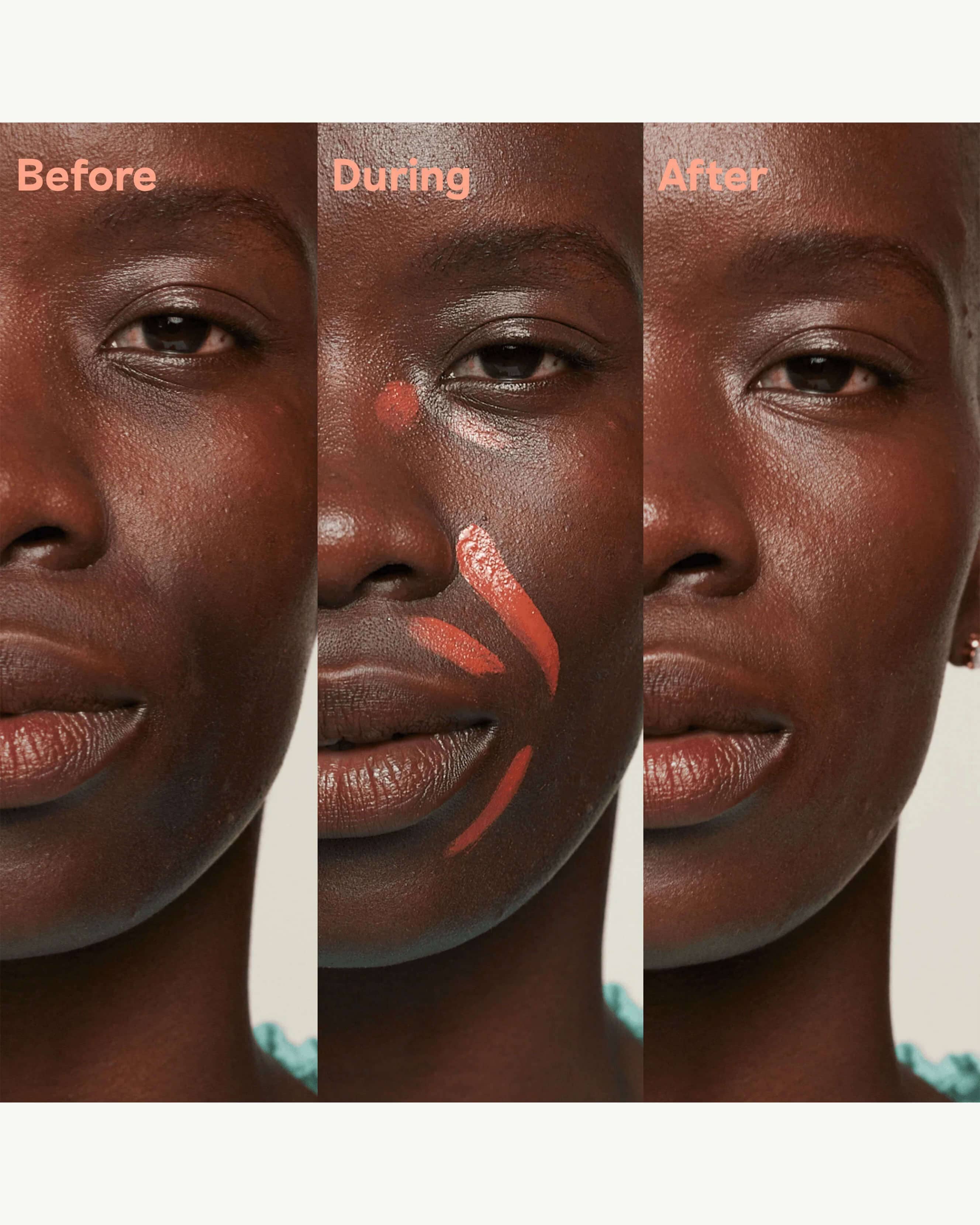 Red-Orange (balances dark spots on deep-dark skin tones)